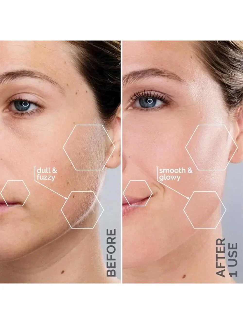 Gentle Dermaplane Razor for Women - Sonic Smooth Facial Hair Remover Tool